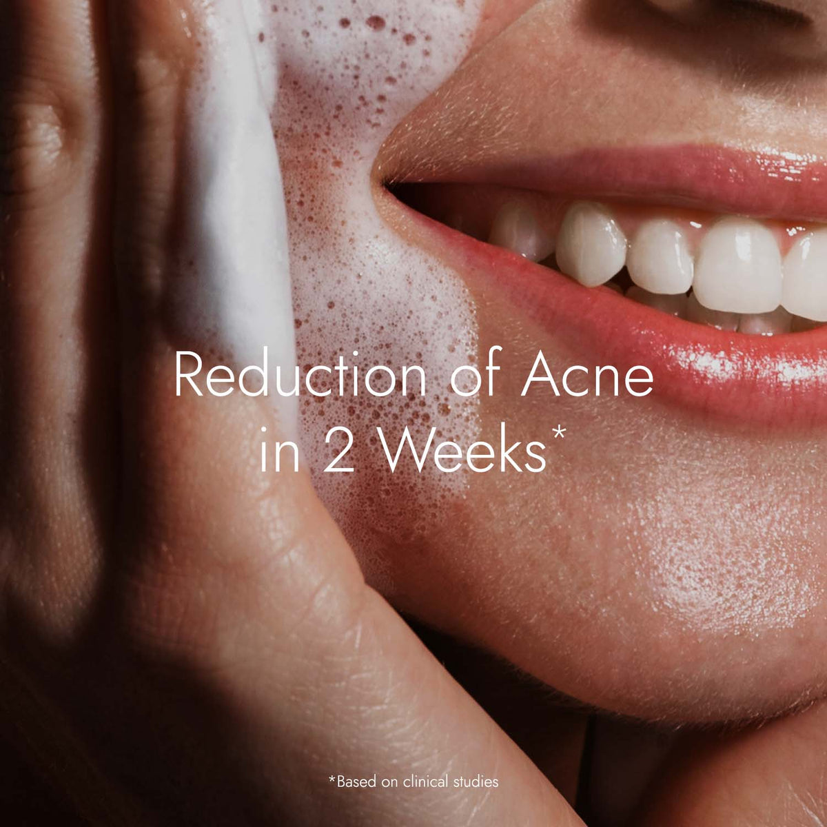 Acne Control Tulsi Face Wash