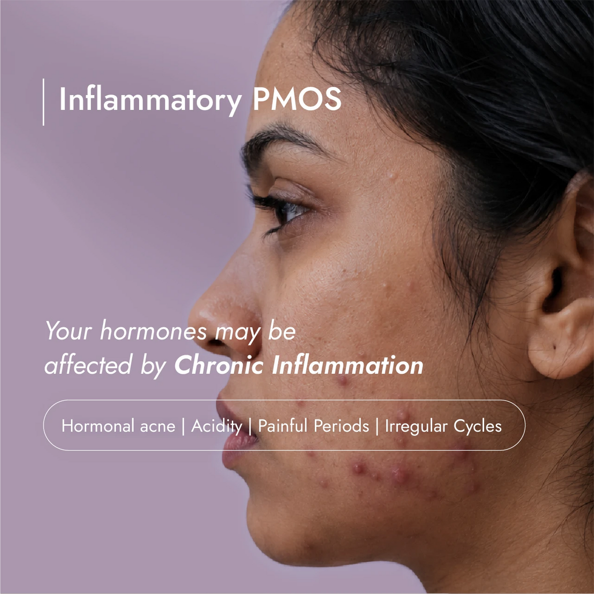 Inflammatory PMOSolve Kit